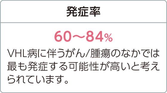 発症率60～84％