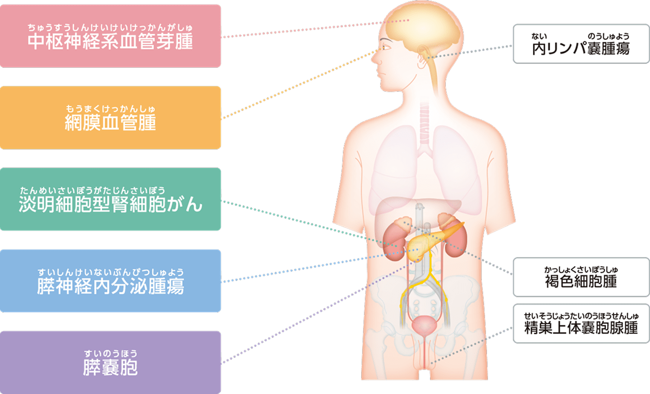いろいろながん/腫瘍の図